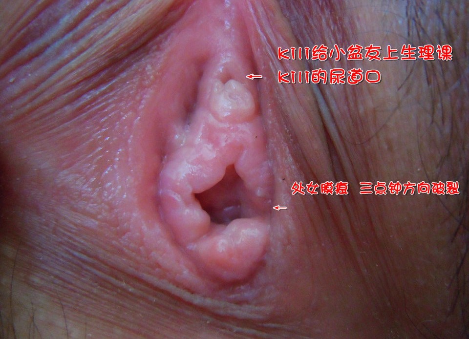 acf7c11186856b4af109f21e146d3cce_e820391df9cb09afe39f285c43071a2e.jpg